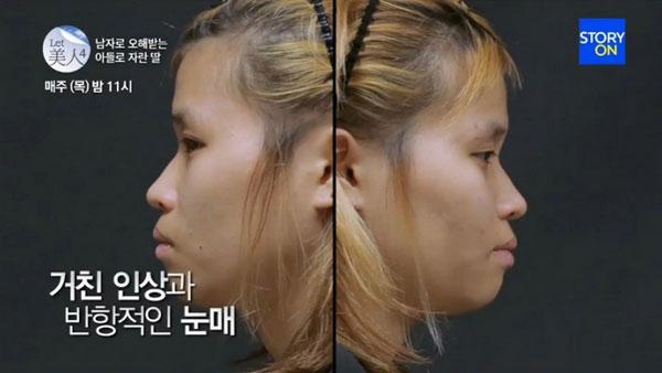 Xấu xí lại bị tấn công tình dục, cô gái Hàn thay đổi cuộc đời nhờ PTTM - Ảnh 10.
