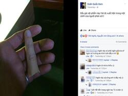 Trần Tú 'Người phán xử' thản nhiên 'rao bán' ngón tay bị chặt của anh trai trên mạng xã hội