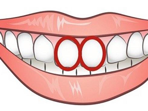 Răng hình oval có liên quan đến chức năng ăn nhai không? 
