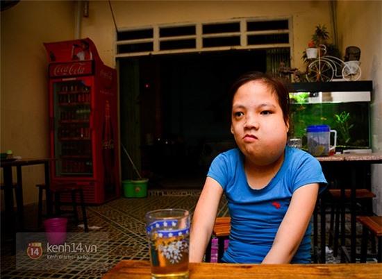 Cô bé 14 tuổi đau đớn vì mặt lại biến dị sau cuộc phẫu thuật 3 tỷ đồng 5
