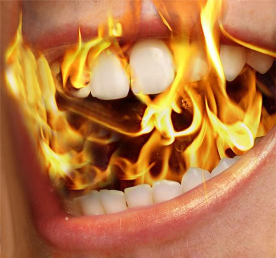 Người mắc bệnh "đốt miệng" thường có cảm giác nóng cháy, đau rát trong miệng.