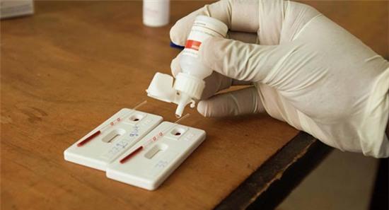 Tìm ra loại thuốc có thể diệt tận gốc HIV
