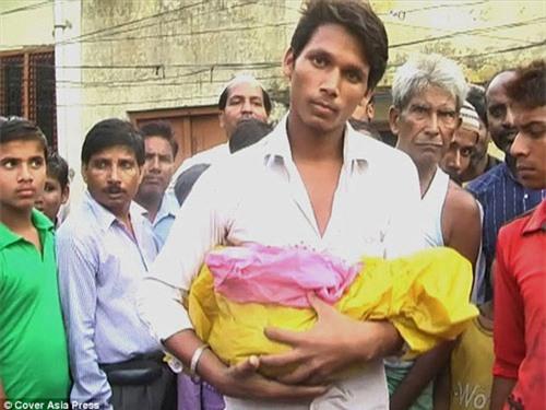 Ấn Độ: Trẻ sơ sinh tử vong vì bác sĩ 'quên' đầu trong bụng mẹ - 2