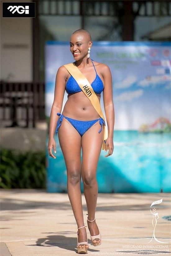 Hoa hậu “đầu trọc” Haiti và thân hình dưới chuẩn của mình