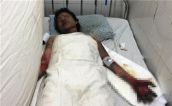 Cô gái mua xăng đốt người yêu