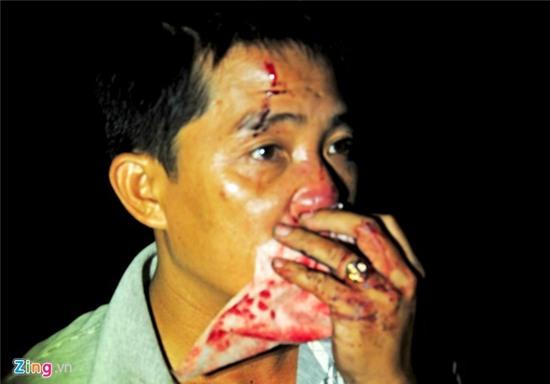 Xe chở khách về Tết lao xuống vực, 30 người bị thương