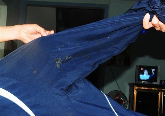 Xem pháo hoa đêm giao thừa, nhiều người nhập viện