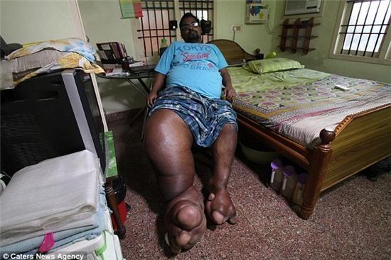 chang trai co chan nang bang... mot chu voi con hinh anh 1