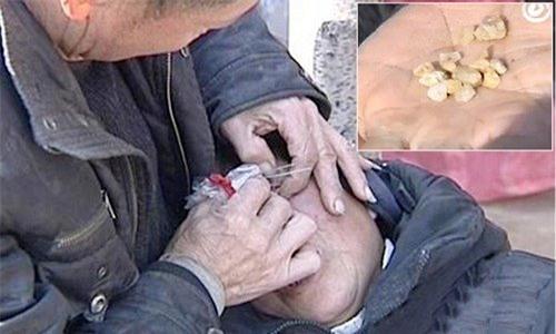 cu ba mac chung benh la: “nuoc mat hoa da” hinh anh 1