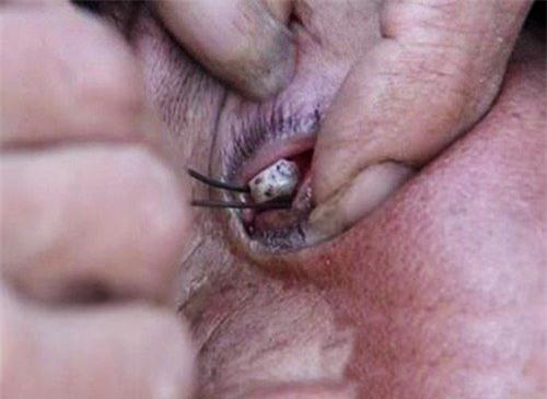 cu ba mac chung benh la: “nuoc mat hoa da” hinh anh 2