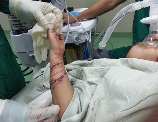 Bé 4 tuổi bị cá sấu cắn ở Cà Mau