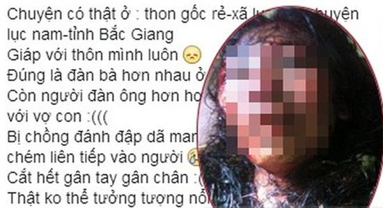 Phẫn nộ hình ảnh người phụ nữ bị chồng bạo hành, cắt đứt gân