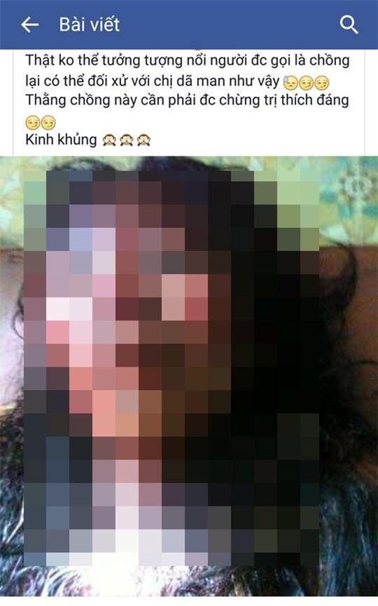  Hình ảnh người phụ nữ bị chồng đánh đập được đăng tải trên mạng xã hội facebook. 