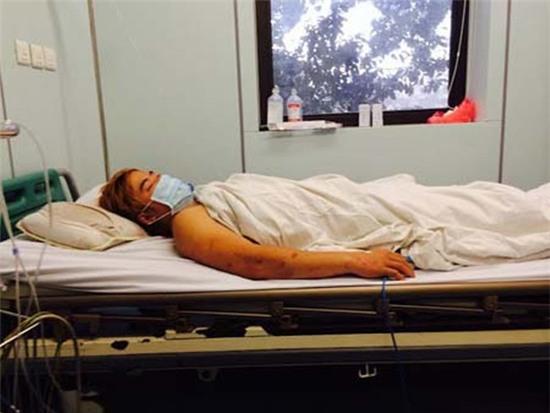 Bộ Y tế chỉ đạo khẩn Sở Y tế các tỉnh phòng chống viêm màng não mô cầu - Ảnh 1.