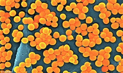 suyt mat mang vi quen bang ve sinh trong nguoi suot 9 ngay - 4