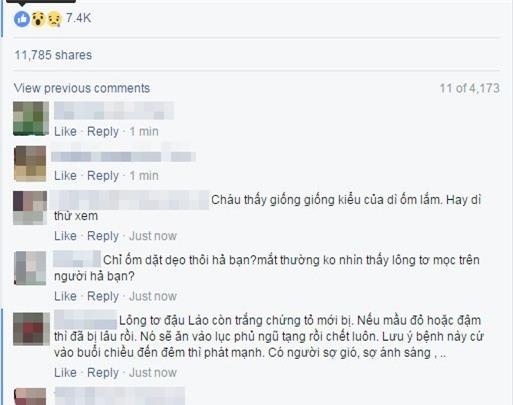 Đắp lông gà lên lưng để chữa bệnh đậu lào là phản khoa học - Ảnh 2.