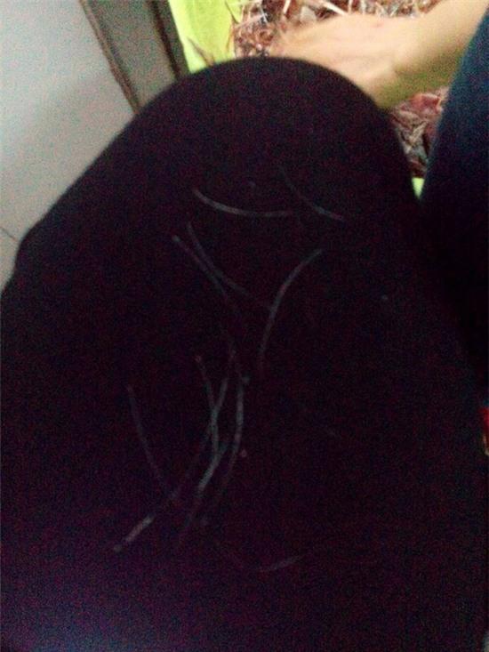 Đắp lông gà lên lưng để chữa bệnh đậu lào là phản khoa học - Ảnh 5.