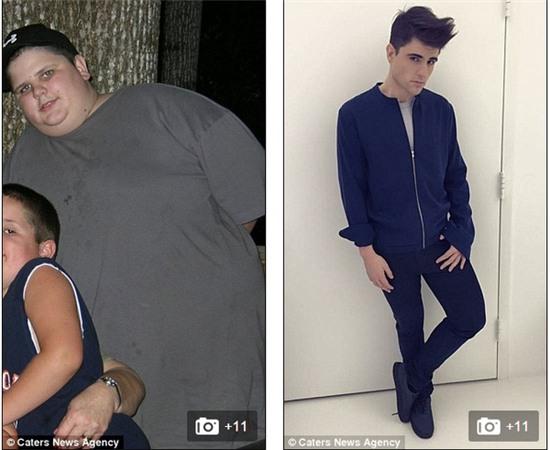 Đẹp trai bất ngờ sau khi giảm tận 71kg chỉ trong 10 tháng - Ảnh 1.