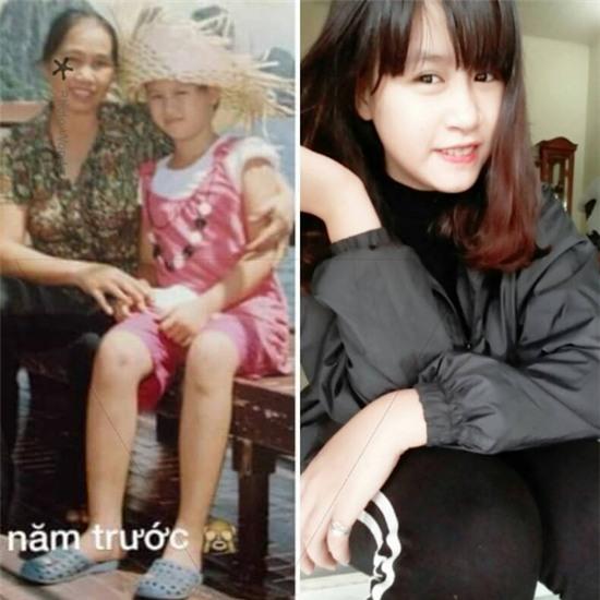 Chị em khoe ảnh “lột xác” ngoạn mục đến mình cũng không nhận ra mình