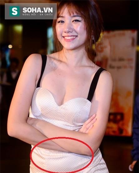 Phần mỡ bụng thừa dễ hay lộ khi Hari Won diện những bộ váy nóng bỏng.