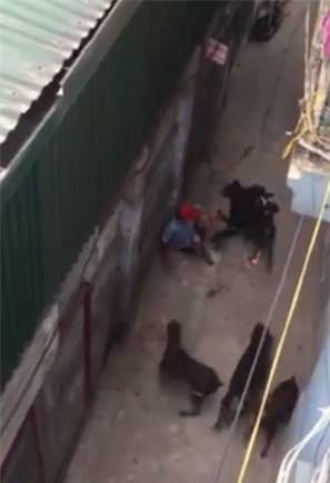 Clip: Kinh hoàng 4 con chó dữ lao vào tấn công khiến chủ đứt gân tay, hôn mê sâu - Ảnh 3.