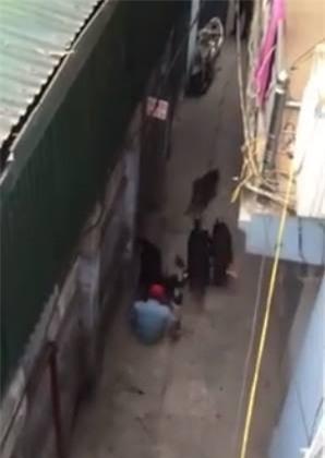 Clip: Kinh hoàng 4 con chó dữ lao vào tấn công khiến chủ đứt gân tay, hôn mê sâu - Ảnh 4.