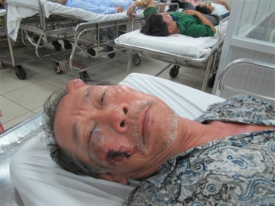 Ông ấy bị quệt xe thôi, làm gì có chuyện bị cướp đánh đập và giật vé số - Ảnh 1.