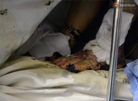 Lời kể kinh hoàng của những nạn nhân may mắn thoát chết trong vụ tai nạn ở đèo Thung Khe - Ảnh 3.