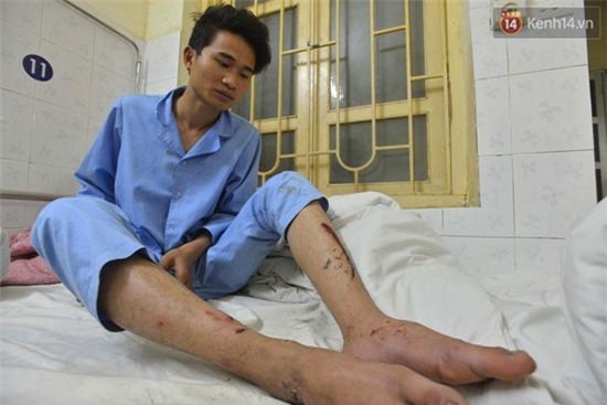 Lời kể kinh hoàng của những nạn nhân may mắn thoát chết trong vụ tai nạn ở đèo Thung Khe - Ảnh 5.