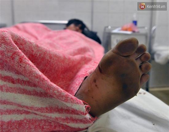 Lời kể kinh hoàng của những nạn nhân may mắn thoát chết trong vụ tai nạn ở đèo Thung Khe - Ảnh 6.