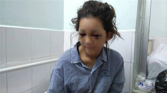 Cô gái Hải Phòng bị người yêu đánh biến dạng mặt: Anh ấy từng dọa giết cả họ nhà tôi - Ảnh 1.