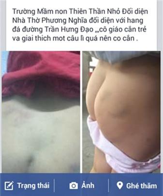 Mô tả ảnh.