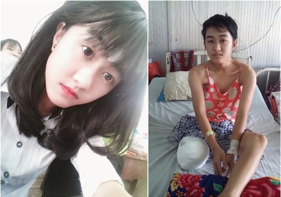 Nước mắt âu lo của người mẹ về tương lai của nữ sinh lớp 10 bị cưa chân - Ảnh 2.