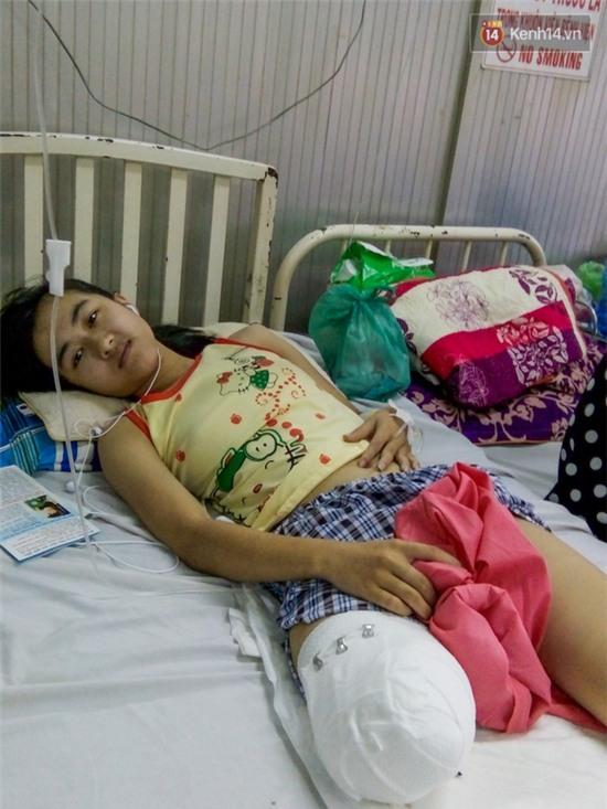 Nước mắt âu lo của người mẹ về tương lai của nữ sinh lớp 10 bị cưa chân - Ảnh 4.