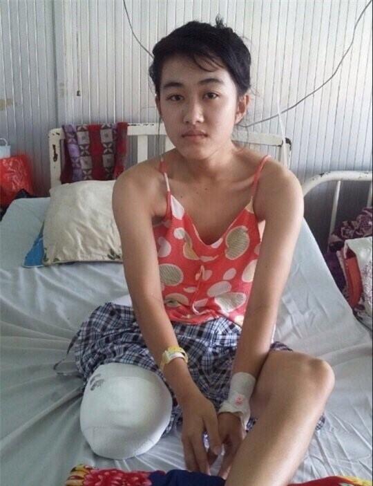 Sở Y tế Đắk Lắk xin lỗi nữ sinh bị cưa chân - Ảnh 1.