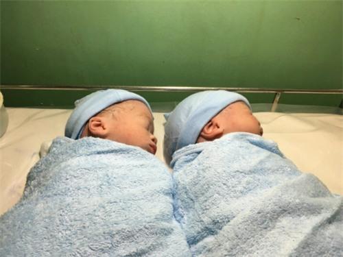 Cặp song sinh ca mang thai hộ đầu tiên miền Nam chào đời khỏe mạnh tại BV Từ Dũ. Ảnh: P.N