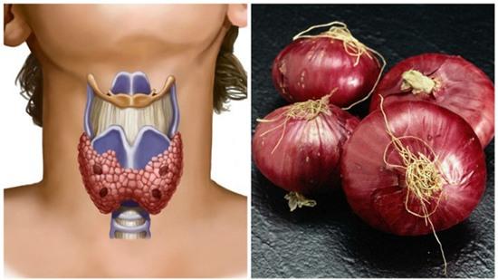 đặt hành lên cổ