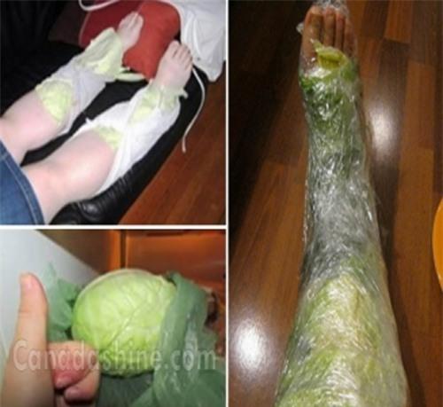 đắp lá bắp cải trước khi ngủ
