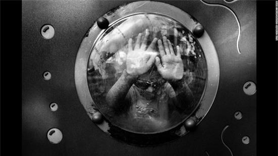 cau-be-mac-benh-ky-la