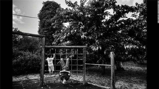 cau-be-mac-benh-ky-la