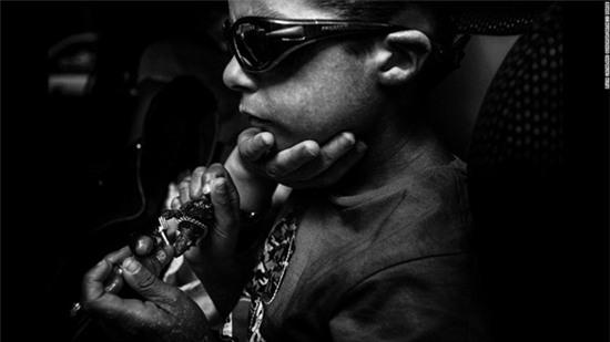 cau-be-mac-benh-ky-la