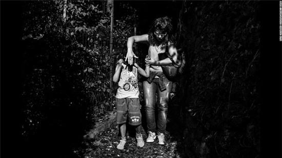 cau-be-mac-benh-ky-la