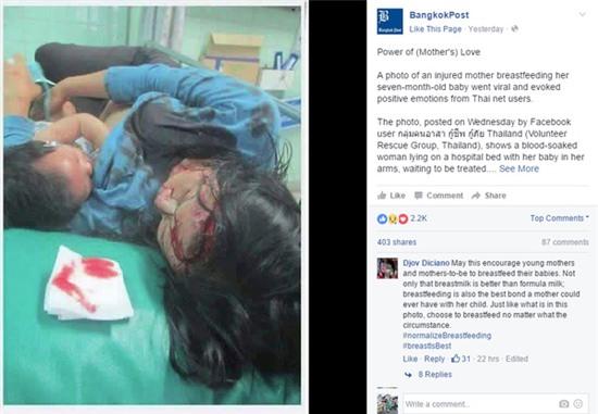 Người mẹ vẫn cho con bú dù bị thương nặng và đang đợi được điều trị - Ảnh 2.