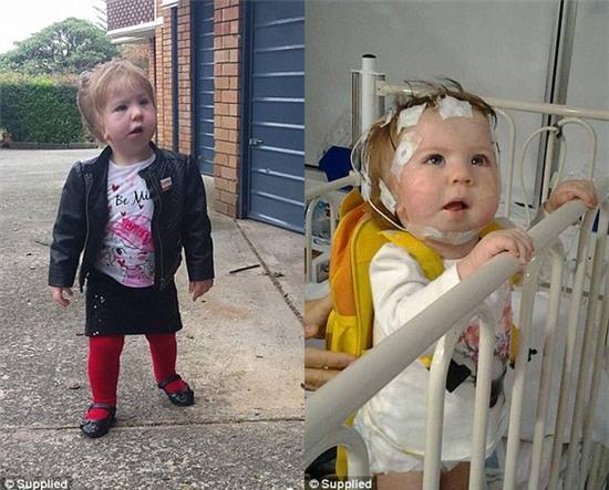 cô bé đáng thương mắc 14 căn bệnh nghiêm trọng