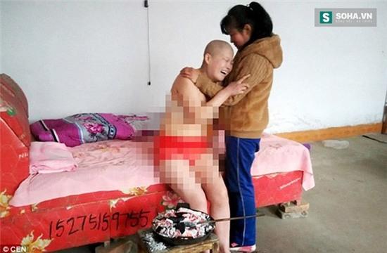 Hy vọng chữa khỏi bệnh, cô gái 28 tuổi này phải chịu đau đớn tuột bậc.