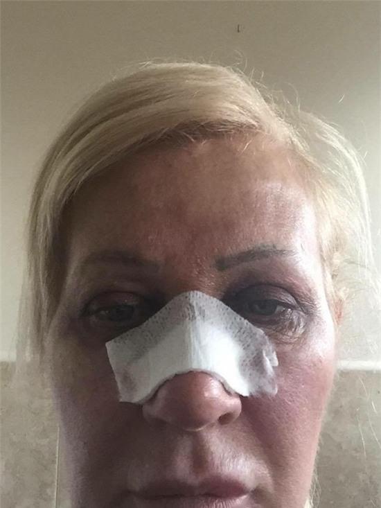 ba-me-nghien-phau-thuat