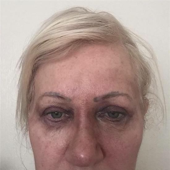 ba-me-nghien-phau-thuat