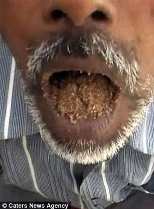 an do: nguoi dan ong an…cat suot 25 nam hinh anh 2