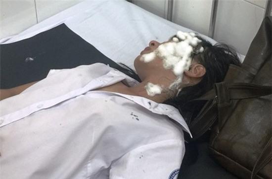 6 tháng sau khi vụ tạt axit hủy hoại khuôn mặt, nữ sinh Sài Gòn chỉ biết giam mình trong bóng tối - Ảnh 1.