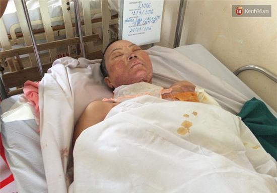 Bé gái 3 tuổi nghịch xăng bên bếp lẩu, cả gia đình bị thiêu sống - Ảnh 2.